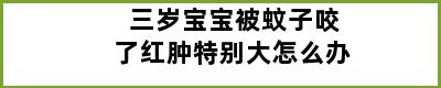 三岁宝宝被蚊子咬了红肿特别大怎么办